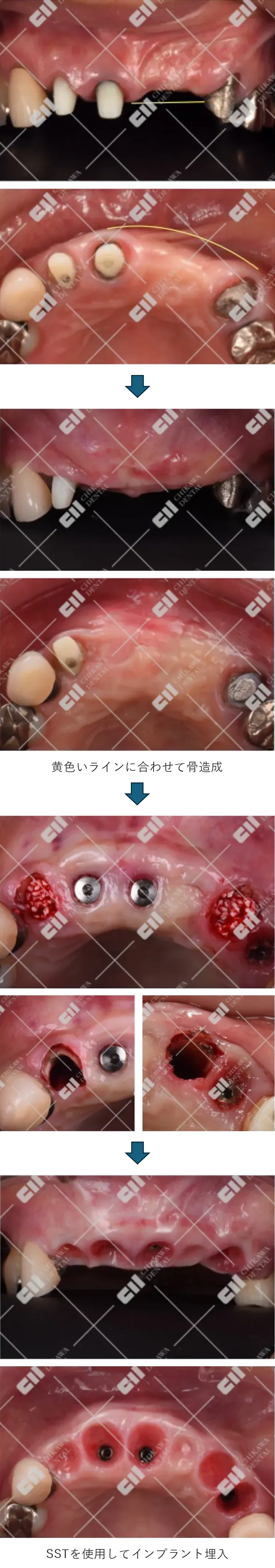 治療中