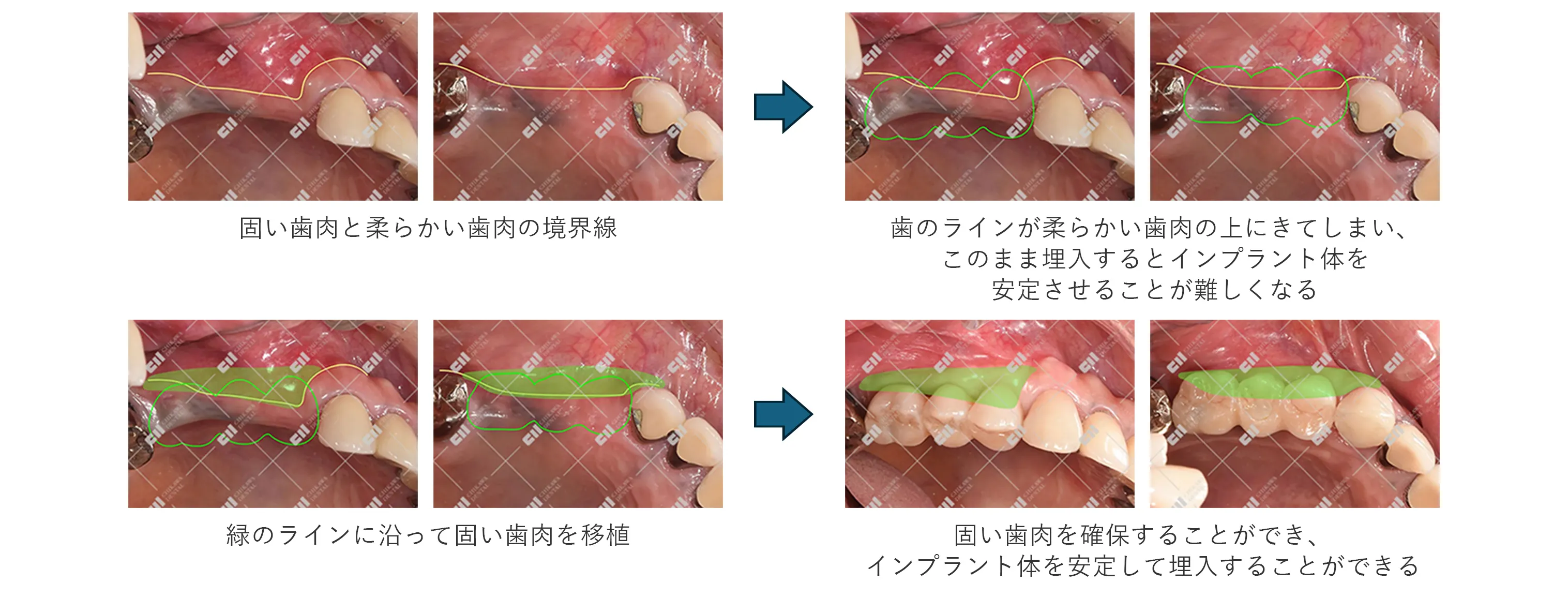 治療中