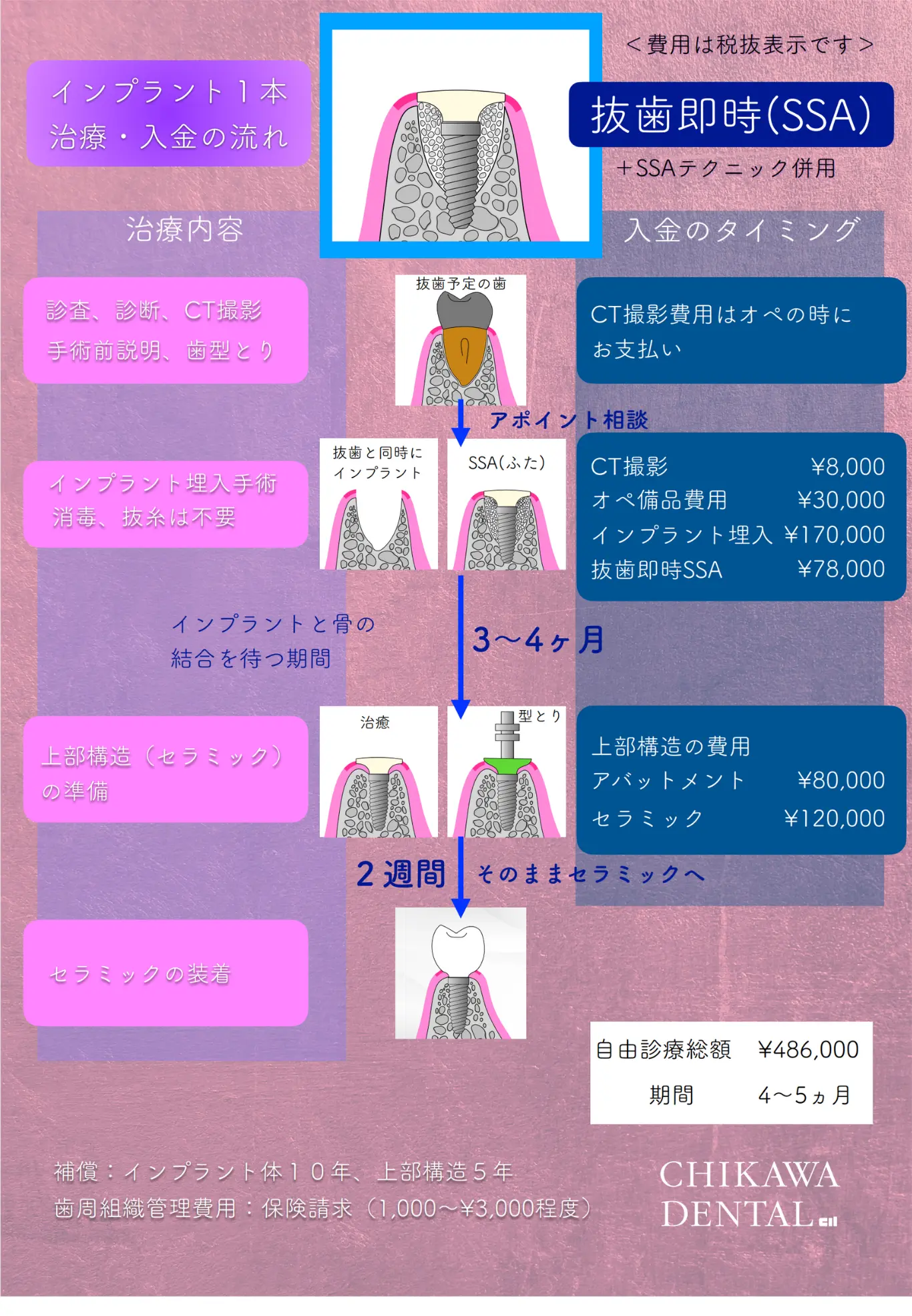 治療の流れと料金例