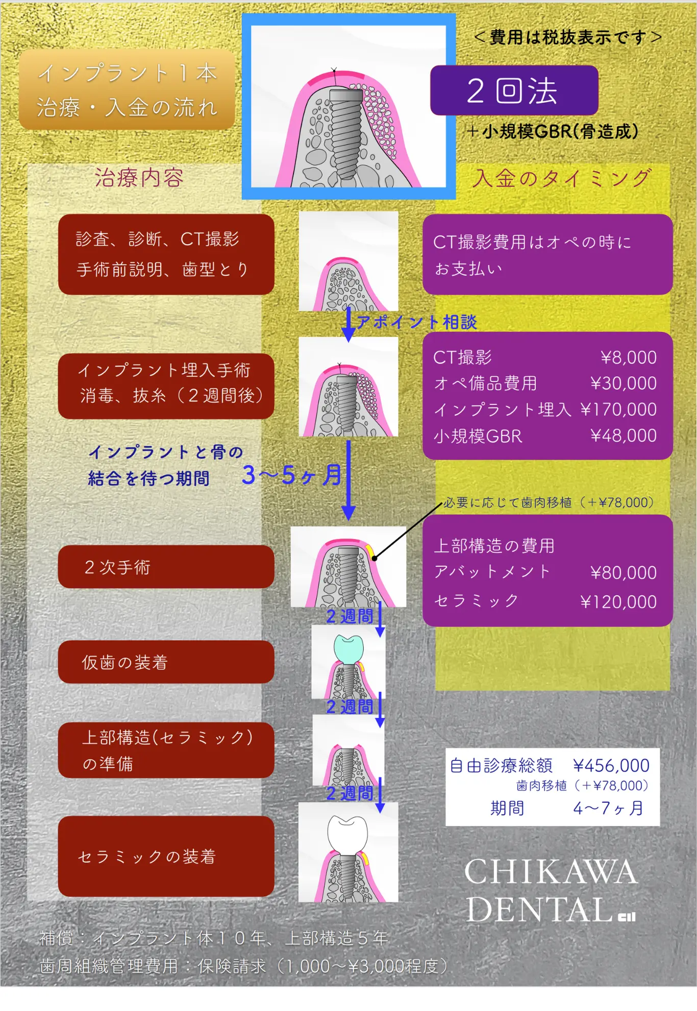治療の流れと料金例