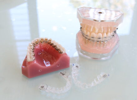 矯正は何歳でもできる？若い人と中高年で違う治療のポイントを歯科医が解説